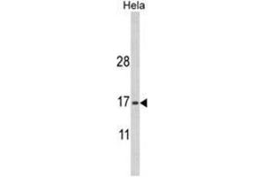 Western blot analysis of MPV17 Antibody (N-term) in Hela cell line lysates (35ug/lane).