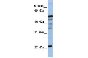 PGDS antibody used at 1 ug/ml to detect target protein. (PTGDS Antikörper  (N-Term))