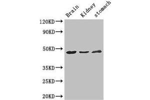 Western Blot Positive WB detected in: Mouse brain tissue, Mouse kidney tissue, Mouse stomach tissue All lanes: AGK antibody at 3 μg/mL Secondary Goat polyclonal to rabbit IgG at 1/50000 dilution Predicted band size: 48, 8 kDa Observed band size: 48 kDa (Acylglycerol Kinase Antikörper  (AA 32-65))