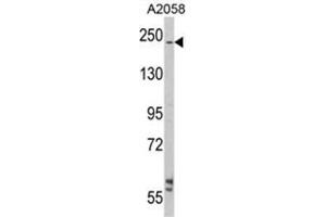 Western blot analysis of LAMB2 Antibody (C-term) in A2058 cell line lysates (35ug/lane). (LAMB2 Antikörper  (C-Term))