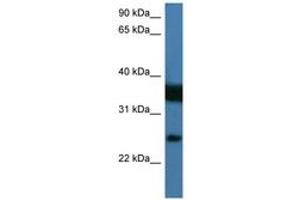 Image no. 1 for anti-Zinc Finger, Matrin Type 2 (ZMAT2) (AA 25-74) antibody (ABIN6746195) (ZMAT2 Antikörper  (AA 25-74))