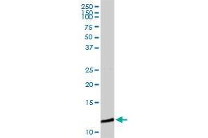B2M MaxPab rabbit polyclonal antibody.