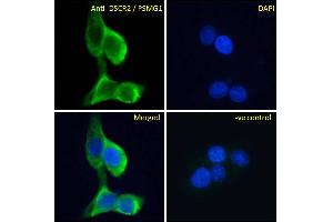 ABIN570956 Immunofluorescence analysis of paraformaldehyde fixed A431 cells, permeabilized with 0.