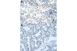 Immunohistochemical staining (Formalin-fixed paraffin-embedded sections) of human kidney (A) and human lung (B) with HNRNPH3 polyclonal antibody  at 4-8 ug/mL working concentration. (HNRNPH3 Antikörper  (N-Term))