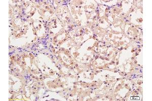 Formalin-fixed and paraffin embedded rat kidney tissue labeled with Anti-CPT1A Polyclonal Antibody, Unconjugated (ABIN677018) at 1:200, followed by conjugation to the secondary antibody and DAB staining (CPT1A Antikörper  (AA 1-100))