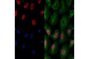ABIN6261257 and ABIN6277502 staining  cells by IF/ICC. (DDX5 Antikörper  (C-Term))