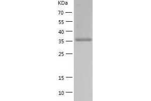 Western Blotting (WB) image for Branched Chain Amino-Acid Transaminase 2, Mitochondrial (BCAT2) (AA 28-392) protein (His tag) (ABIN7284376) (BCAT2 Protein (AA 28-392) (His tag))