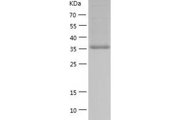 BCAT2 Protein (AA 28-392) (His tag)