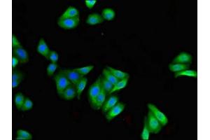 Immunofluorescent analysis of HepG2 cells using ABIN7152948 at dilution of 1:100 and Alexa Fluor 488-congugated AffiniPure Goat Anti-Rabbit IgG(H+L) (FILIP1 Antikörper  (AA 957-1192))