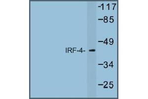 Image no. 1 for anti-Interferon Regulatory Factor 4 (IRF4) antibody (ABIN317672) (IRF4 Antikörper)