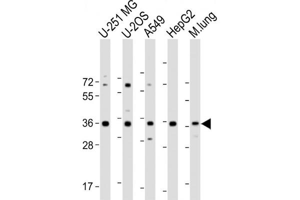 RCN3 Antikörper  (AA 134-163)