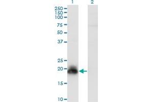 Western Blot analysis of HAND2 expression in transfected 293T cell line by HAND2 monoclonal antibody (M09), clone 2C10. (HAND2 Antikörper  (AA 135-216))