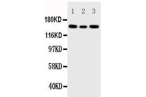 Anti-IGF1 Receptor antibody, Western blotting Lane 1: 293T Cell Lysate Lane 2: A549 Cell Lysate Lane 3: MCF-7 Cell Lysate (IGF1R Antikörper  (C-Term))