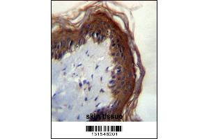 LIPM Antibdy immunohistochemistry analysis in formalin fixed and paraffin embedded human skin tissue followed by peroxidase conjugation of the secondary antibody and DAB staining. (LIPM Antikörper  (C-Term))