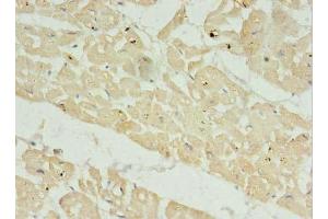 Immunohistochemistry of paraffin-embedded human heart tissue using ABIN7165422 at dilution of 1:100 (FAM156A Antikörper  (AA 1-153))