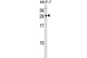 Western Blotting (WB) image for anti-Lipoyl(octanoyl) Transferase 2 (Putative) (LIPT2) antibody (ABIN3000020) (LIPT2 Antikörper)