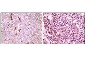 Immunohistochemical analysis of paraffin-embedded human thalamus (left) and glioma (right) tissue, showing membrane localization using CIB1 mouse mAb with DAB staining.