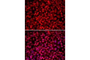Immunofluorescence analysis of U2OS cells using NCOA1 antibody (ABIN5970476). (NCOA1 Antikörper)
