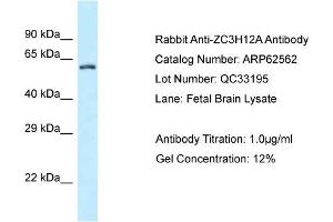 Western Blotting (WB) image for anti-Zinc Finger CCCH-Type Containing 12A (ZC3H12A) (C-Term) antibody (ABIN2789180) (ZC3H12A Antikörper  (C-Term))