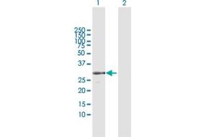 Western Blot analysis of RPA4 expression in transfected 293T cell line by RPA4 MaxPab polyclonal antibody. (RPA4 Antikörper  (AA 1-261))