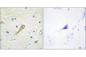 Immunohistochemistry analysis of paraffin-embedded human brain tissue, using SEMA4A Antibody. (Sema4a Antikörper  (AA 501-550))