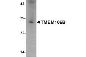 Western blot analysis of TMEM106B in human liver tissue lysate with TMEM106B antibody at 1 ug/mL. (TMEM106B Antikörper  (N-Term))