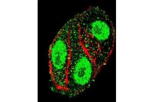 Confocal Immunofluorescent analysis of SFTPC Antibody (N-term) Cat. (Surfactant Protein C Antikörper  (N-Term))