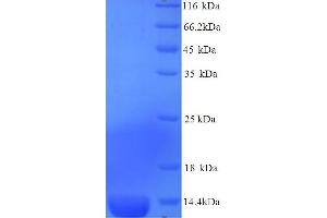 SDS-PAGE (SDS) image for Serum Amyloid A3 Pseudogene (SAA3P) (AA 20-122) protein (His tag) (ABIN5714204) (Serum Amyloid A3 Pseudogene (SAA3P) (AA 20-122) protein (His tag))