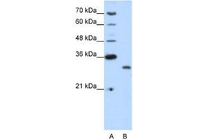 WB Suggested Anti-CPXCR1 Antibody Titration:  1.