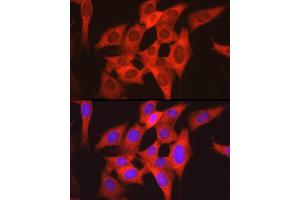 Immunofluorescence (IF) image for anti-Ribosomal Protein S6 (RPS6) (AA 1-100) antibody (ABIN6147227)