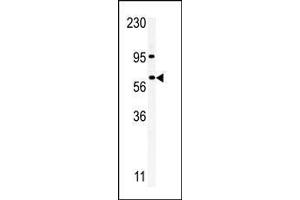 Western blot analysis of anti-RIOK1 Pab in A375 cell line lysate.