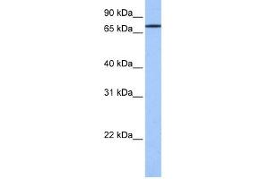 WB Suggested Anti-GK2 Antibody Titration: 0.