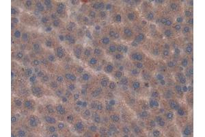 Used in DAB staining on fromalin fixed paraffin- embedded kidney tissue (Vip Antikörper  (AA 34-157))