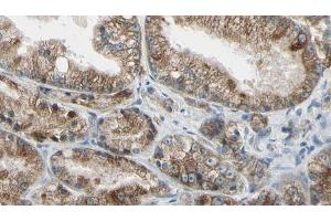 ABIN6273991 at 1/100 staining Human prostate tissue by IHC-P. (TUBA4A Antikörper  (N-Term))