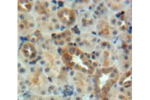 Used in DAB staining on fromalin fixed paraffin-embedded Kidney tissue (BMP7 Antikörper  (AA 30-431))