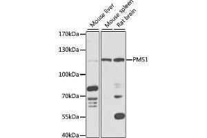 Western blot analysis of extracts of various cell lines, using PMS1 antibody (ABIN6128473, ABIN6145826, ABIN6145827 and ABIN6218265) at 1:1000 dilution. (PMS1 Antikörper  (AA 405-619))