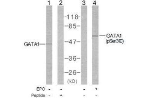 Image no. 1 for anti-GATA Binding Protein 1 (Globin Transcription Factor 1) (GATA1) (Ser310) antibody (ABIN197170) (GATA1 Antikörper  (Ser310))