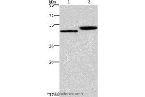 Western blot analysis of Human stomach cancer and mouse stomach tissue, using CTSE Polyclonal Antibody at dilution of 1:450