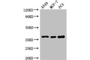 Western Blot Positive WB detected in: A549 whole cell lysate, MCF-7 whole cell lysate, PC-3 whole cell lysate All lanes: SLC9A3R2 antibody at 3 μg/mL Secondary Goat polyclonal to rabbit IgG at 1/50000 dilution Predicted band size: 38, 37, 25 kDa Observed band size: 38 kDa (SLC9A3R2 Antikörper  (AA 106-313))