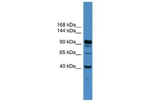 WB Suggested Anti-IFT88 Antibody Titration: 0. (IFT88 Antikörper  (Middle Region))