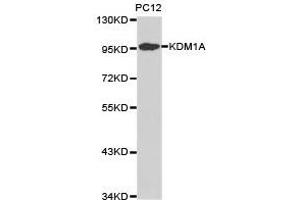 Western Blotting (WB) image for anti-Lysine (K)-Specific Demethylase 1A (KDM1A) antibody (ABIN1873389) (LSD1 Antikörper)