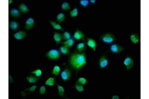 Immunofluorescence (IF) image for anti-Casein Kinase 1, epsilon (CSNK1E) (AA 1-416), (Isoform epsilon) antibody (ABIN7146862)
