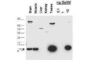 Western blot using  anti-SelW antibody shows detection of endogenous SelW in mouse brain, muscle and testes lysates. (Selenoprotein W Antikörper)