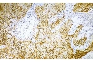 Image no. 1 for anti-Vimentin (VIM) antibody (ABIN335382) (Vimentin Antikörper)