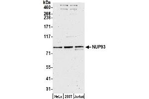 anti-Nucleoporin 93kDa (NUP93) (AA 606-656) antibody