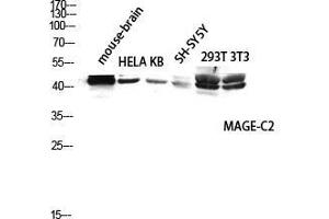 Western Blot (WB) analysis of Mouse Brain HeLa KB SH-SY5Y 293T 3T3 lysis using MAGE-C2 antibody. (MAGEC2 Antikörper  (Internal Region))
