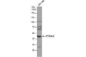 WB Image ST3GAL5 antibody detects ST3GAL5 protein by western blot analysis. (ST3GAL5 Antikörper)