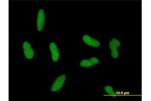 Immunofluorescence of purified MaxPab antibody to ZNF461 on HepG2 cell. (ZNF461 Antikörper  (AA 1-563))