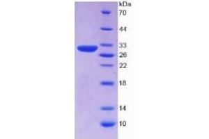 SDS-PAGE (SDS) image for serpin Peptidase Inhibitor, Clade B (Ovalbumin), Member 3 (SERPINB3) ELISA Kit (ABIN6574275)