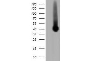 Western Blotting (WB) image for anti-Pleckstrin (PLEK) antibody (ABIN1500271) (Pleckstrin Antikörper)